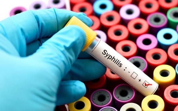 Puluhan Kasus Raja Singa Ditemukan di Cimahi, Inilah Ciri-ciri Penderita Sifilis