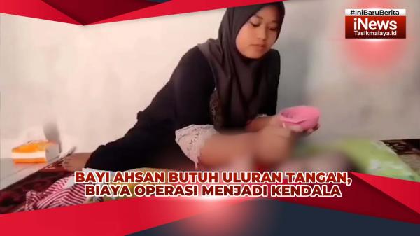 VIDEO: Bayi Pengidap Hidrosefalus Warga Karangnunggal Tasikmalaya Butuh Bantuan Biaya Operasi