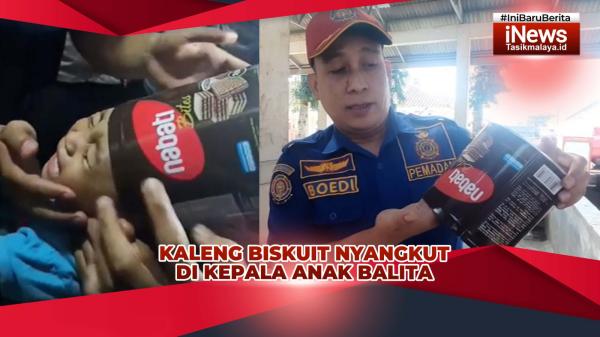 VIDEO: Kaleng Biskuit Nyangkut di Kepala Anak Balita di Tasikmalaya, Dievakuasi Petugas Damkar