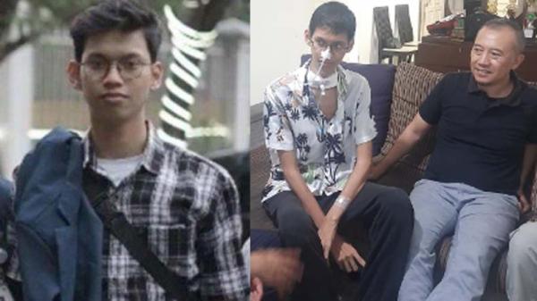 Pilu Mahasiswa UB Tak Bisa Bicara usai Terjerat Kabel, Nangis ke Jokowi Ingin Kuliah Lagi