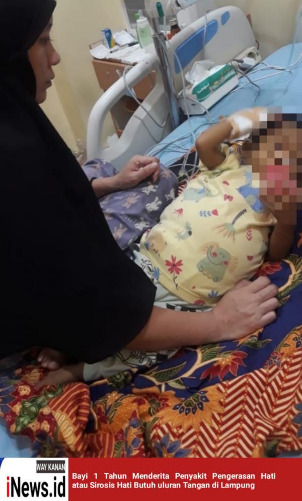 Bayi 1 Tahun Menderita Penyakit Pengerasan Hati atau Sirosis Hati, Butuh uluran Tangan di Lampung