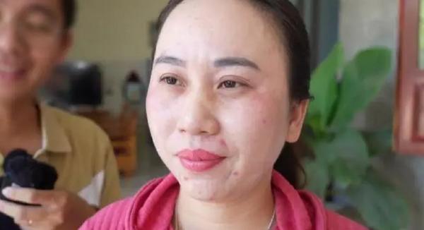 Mengenal Tran Thi Luu, Wanita Vietnam yang Mengaku Tidak Tidur selama 11 Tahun