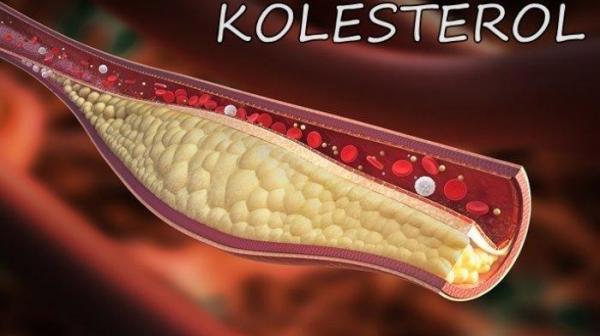 5 Cara Ampuh Turunkan Kolesterol Tinggi Secara Alami Tanpa Obat! Yuk Baca Artikel ini