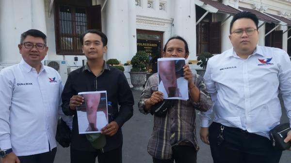 DPD Perindo Dampingi Anggota Karang Taruna, Korban Penganiayaan Lapor ke Polrestabes Surabaya