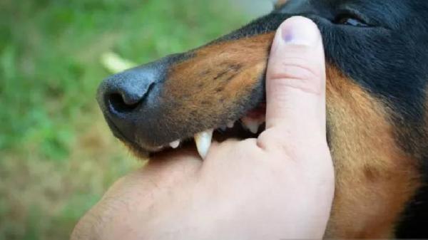 Ngeri, Anjing Liar Serang 6 Warga Abdya, 1 Orang Luka di Bagian Kemaluan