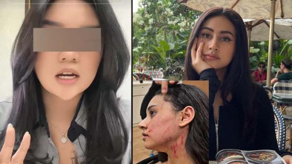 Sosok Terduga Pelaku yang Cakar Afifah Riyad Rupanya Selebgram, Netizen: Muka Cantik Kelakuan Preman
