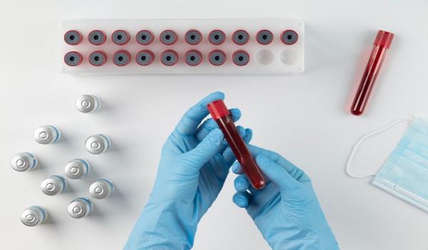 Super Langka! Golongan Darah Tipe P Pertama di Dunia Ditemukan di China