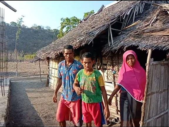 Kisah Pilu Pasutri di Manggarai Timur Rawat Anak Cacat di Gubuk Reyot