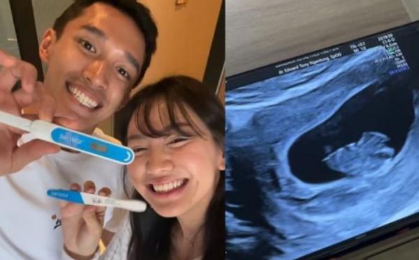 Kabar Bahagia, Jonathan Christie dan Istri Umumkan Kehamilan Anak Pertama