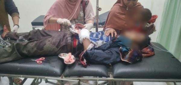 Tragis, Gegara Token Listrik Dua Saudara Saling Bacok Pakai Parang di Aceh Tengah