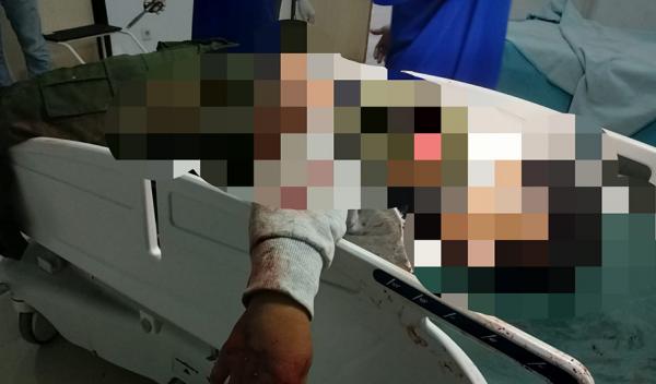 Saling Ejek di Medsos, Pelajar SMK Purwodadi Kritis akibat Sabetan Sajam saat Tawuran
