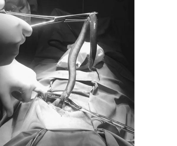 Dokter Kaget Lihat Belut Hidup dalam Perut Pria Ini saat Operasi, Begini Ceritanya