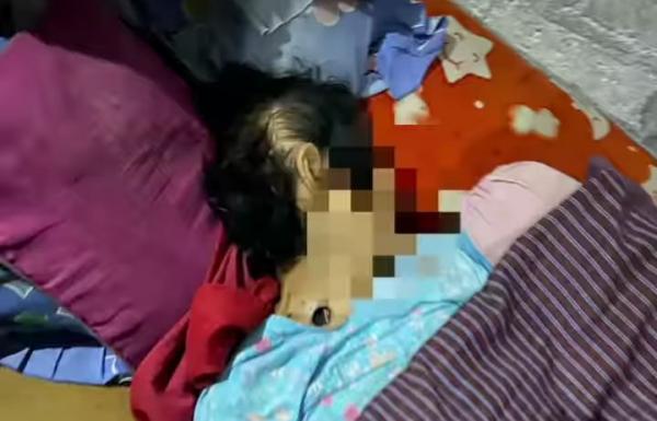 Sadis Anak Bunuh Ibu Kandung, Leher Disayat dan Mata Kanan Dicungkil