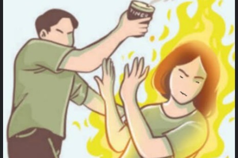 Diduga Karena Api Cemburu Suami di Cirebon Bakar Istri Saat Tertidur