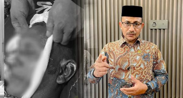 Kronologis Warga Meninggal Dunia Diduga Dianiaya Oknum Polisi,  H Uma Minta Polda Aceh Usut Tuntas