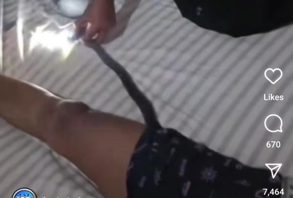 Bikin Ngilu! Ular Kobra Masuk ke Celana Dalam Pria Sedang Tidur, Netizen Nanya Telurnya Masih Ada?