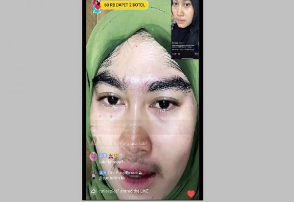 Mengerikan Wajah Wanita Ini Muncul Bulu Lebat Usai Pakai Skincare, Sumpah Malah Seram