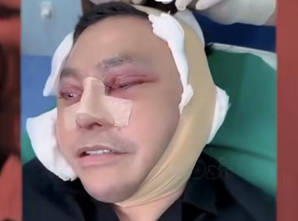 Video Oplas Ujang Iskandar di Vietnam Sebelum Ditangkap Tim Kejaksaan Viral di Medsos