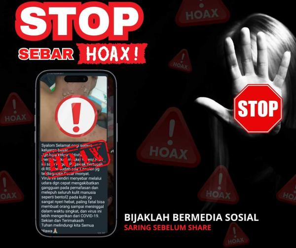 Viral Pasien Virus Monkeypox Dirawat di RSUD Abepura, Kapolsek: Itu Informasi Hoax