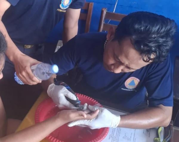 Detik-detik Menegangkan Pelepasan Cincin di Jari Pelajar Jombang, Dipotong Pakai Gerinda