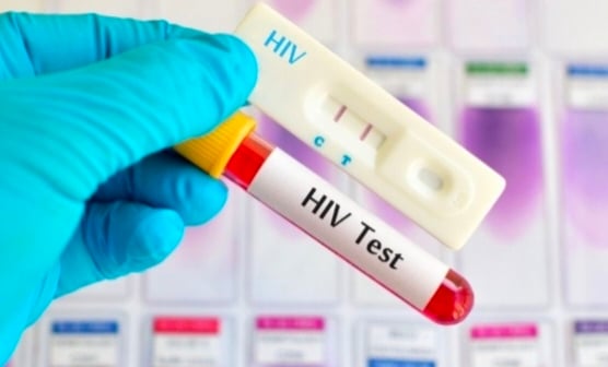 Terbukti Reaktif  HIV dan Sifilis, Pemeriksaan Pesta Gay di Puncak Bogor