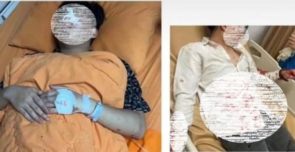 Mahasiswa Unisba Babak Belur Berlumuran Darah Dikeroyok 15 Orang di Area Kampus