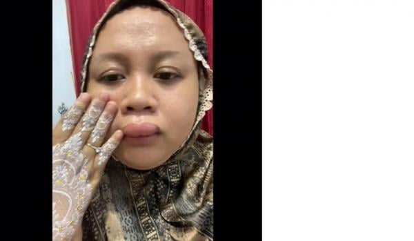 Viral Bibir Calon Pengantin Mendadak Bengkak Jelang Dirias, Warganet Sebut Efek Dosa ke Mantan