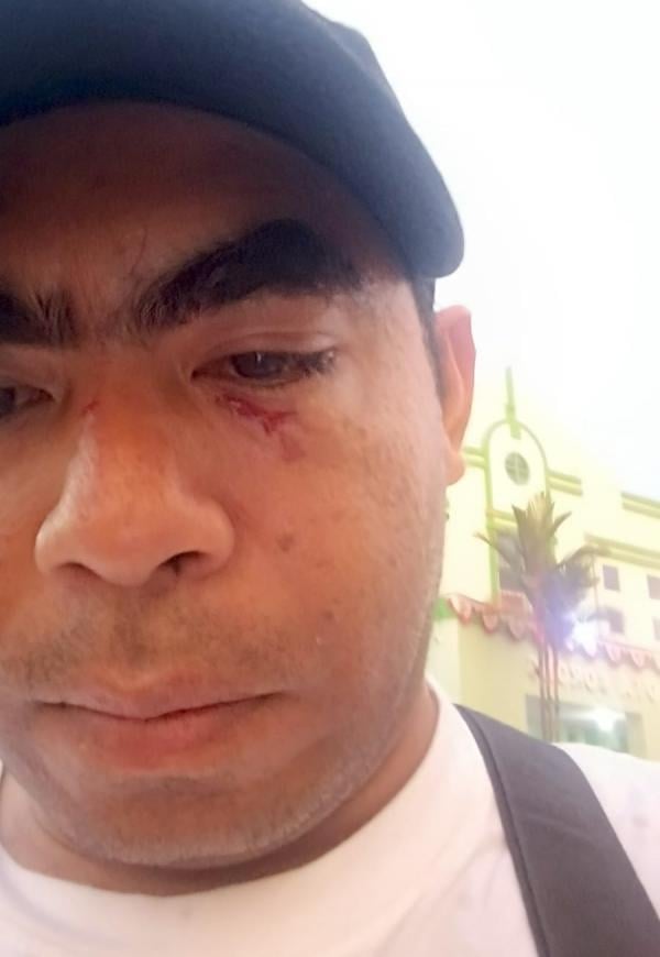 Pengacara LBH PBHKP Sorong Jadi Korban Penganiayaan, Kritik Polisi Lepas Pelaku
