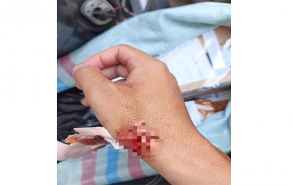 Gara-gara Paket COD, Kurir Ini Dibacok Pelanggan di Bekasi Utara