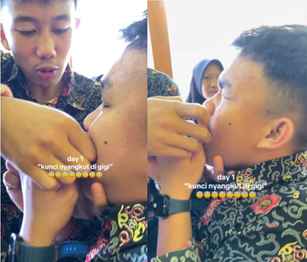 Heboh! Kunci Motor Tersangkut di Gigi Siswa Viral, Aksinya Bikin Warganet Geleng-Geleng