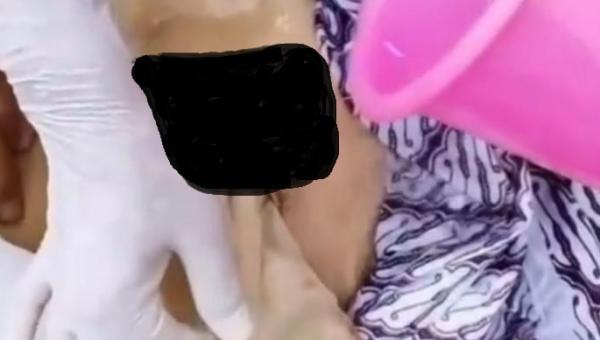 Viral! Warga Bekasi Meninggal usai Operasi, Kain Kasa Ditemukan di Dalam Perut Diduga Malapraktik
