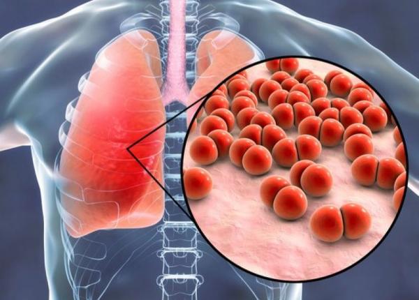 Hari Pneumonia Sedunia, Saatnya Mengenal Penyakit Paling Mematikan bagi Bayi