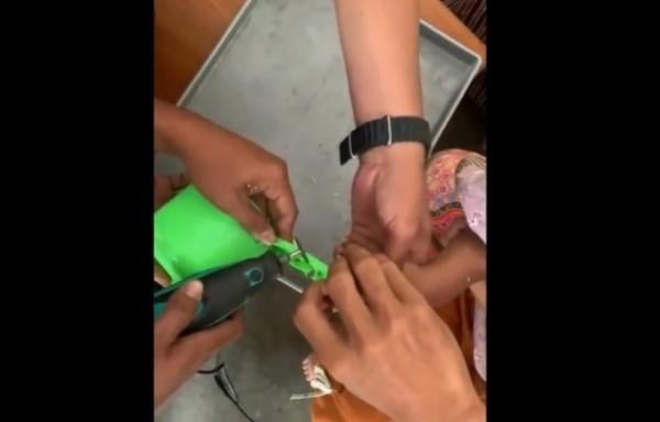 Bikin Warga Panik! Jari Bocah Tersangkut Gagang Gayung, Damkar Bergerak Cepat