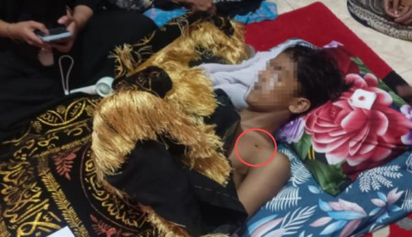 Pelajar Tewas Tertembak Senapan Angin di Dada Kiri saat Tawuran di Makassar