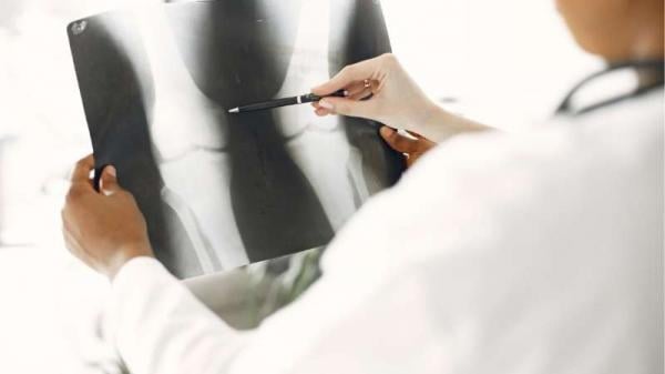 Mahasiswa Radiologi Wajib Tahu: Ini Pentingnya Studi Lapangan ke Rumah Sakit