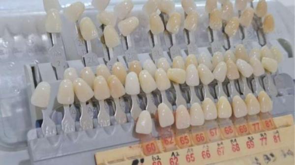 Profesi Teknisi Gigi Langka Tapi Menjanjikan, Peluang Karier Terbuka Lebar di Indonesia