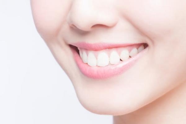 Riset: 27,6 Persen Perempuan Indonesia Tidak Percaya Diri dengan Kondisi Gigi