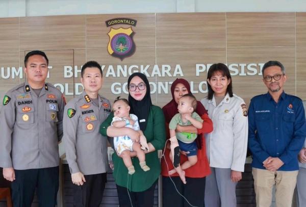 Sambut Hari Bhayangkara ke-80, Polda Gorontalo Gelar Operasi Bibir Sumbing Gratis