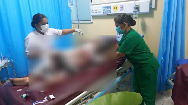 Polres Jayapura Dalami Dugaan Kekerasan Ibu Angkat Bakar Anak 15 Tahun Hingga Meninggal Dunia
