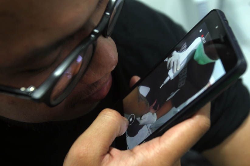 Melihat Proses Menghilangkan Tato di Badan - Bagian 10