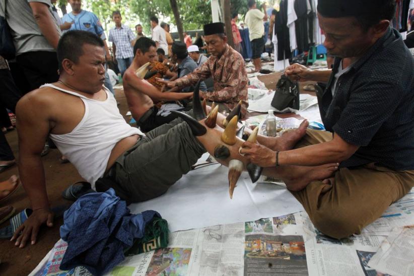 Unik, Terapi Bekam dengan Tanduk Kerbau - Bagian 4