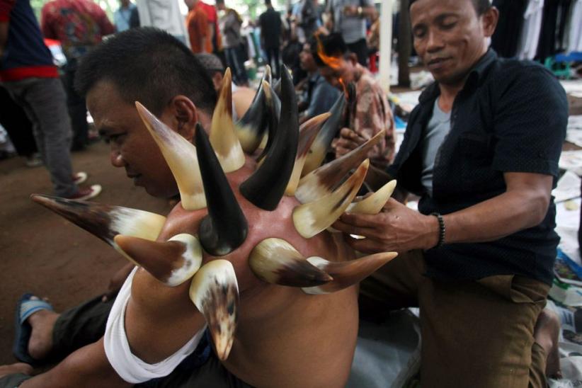 Unik, Terapi Bekam dengan Tanduk Kerbau - Bagian 2