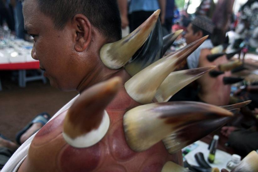 Unik, Terapi Bekam dengan Tanduk Kerbau - Bagian 8