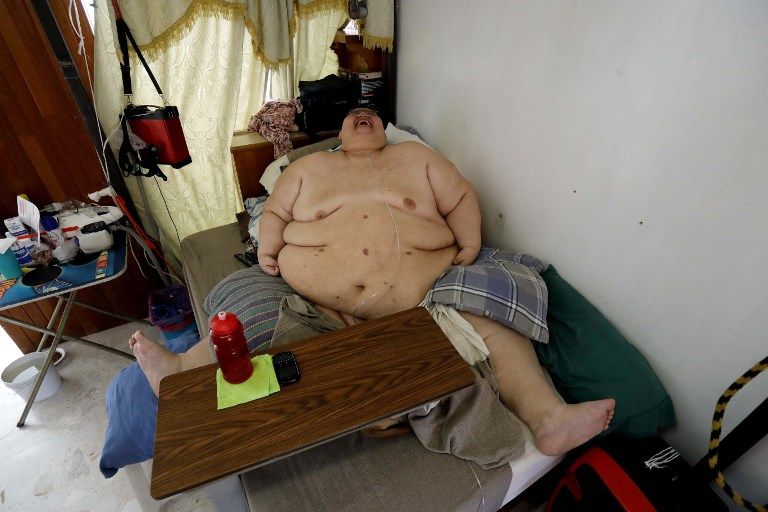 Melihat Perjuangan Pria Terberat di Dunia Pangkas Bobot Tubuh dengan Berolahraga - Bagian 3