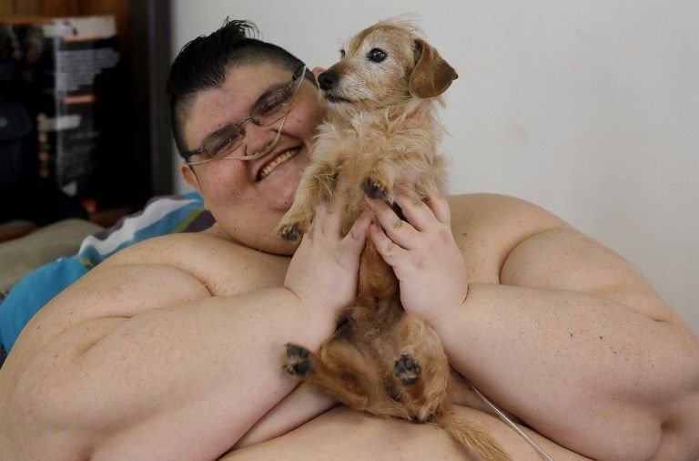 Melihat Perjuangan Pria Terberat di Dunia Pangkas Bobot Tubuh dengan Berolahraga - Bagian 4