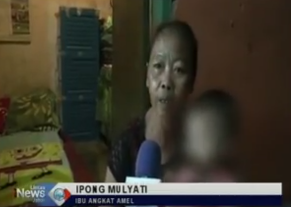 Idap Kanker Kulit, Balita asal Sumedang Dibuang Orang Tuanya