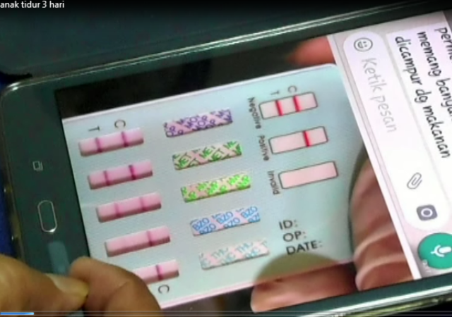 Usai Makan Permen, Bocah TK di Banyumas Ini Tertidur 3 Hari 