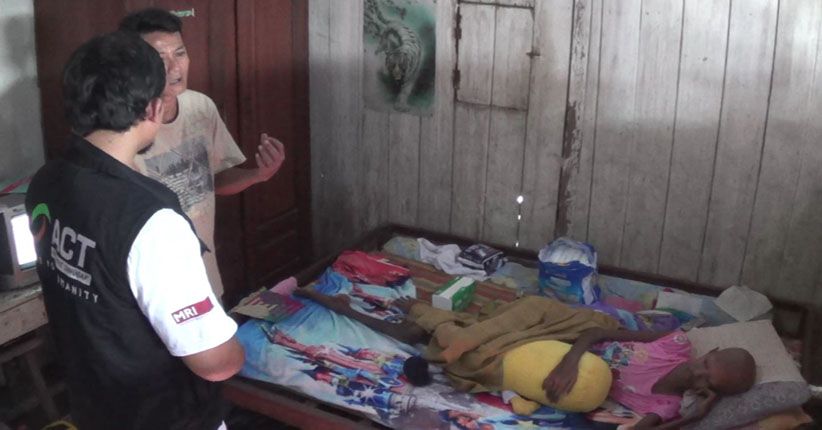 Derita Kanker Tulang, Siswi SMP di Kendal Ini Terpaksa Putus Sekolah