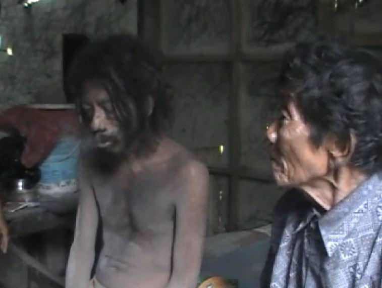 Perjuangan Kakek Tua di Tengah Hutan Wonogiri Rawat Anaknya yang Gila