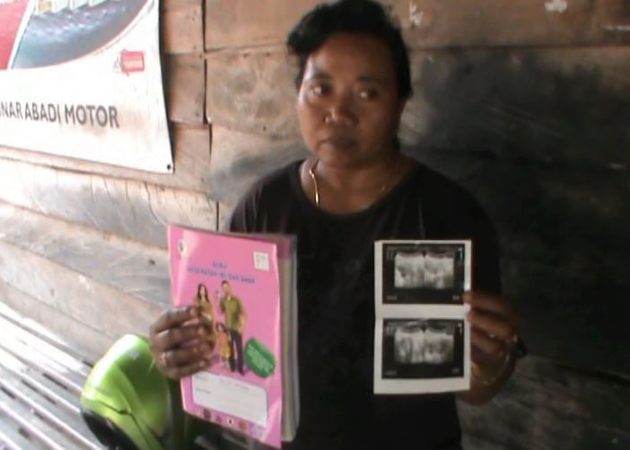 Usia Kandungan Empat Bulan, Janin di Perut Tiba-Tiba Hilang